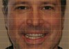 Figure 4  A yellow grid was applied to an eyebrow-to-chin preoperative face photograph.