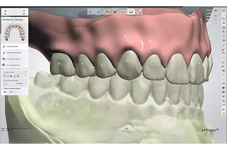 Success with Digital Dentures