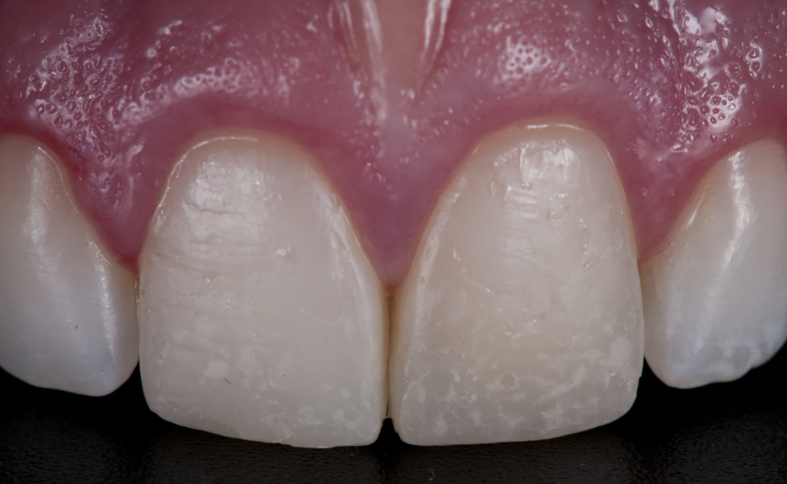 Updating Classifications of Dental Ceramic Materials
