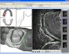 Figure 8  Margin identification of the prepared tooth in the margin marking program.