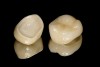 Figure 16  Completely processed crowns.