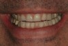 Figure 2  Preoperative view of the patient’s smile.