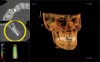 Figure 4  A postoperative evaluation.