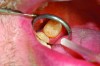 Fig 3. Eight months later, diastemas have developed between the mandibular second and first molars.