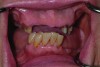 The patient’s intraoral condition.