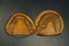 Fig 7. Occlusal view of overlay acetal resin partial overdenture framework. (Photograph courtesy of Dr. Ingeborg De Kok.)