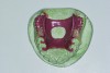 Fig 9. Occlusal view of maxillary RPD framework on working model.