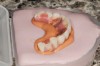 Fig 11. Denture-duplicating process.