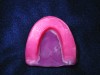 Fig 2. Wax rim with record base.