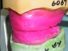 Fig 3. Wax rim with midlines marked.