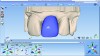 Fig 3. Full-contour restoration before crystallization and cutback.