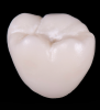 Fig 12. Monolithic molar crown fired at 30°C lower than the ideal temperature determined to develop optimal translucency. Note the significantly increased opacity relative to Figure 13.