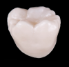 Fig 14. Monolithic molar crown fired 30°C higher than the ideal temperature determined to develop optimal translucency. Note
the slight increased opacity relative to Figure 12.