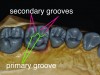 Fig 6. Cusps are divided by primary and secondary grooves.