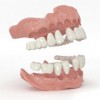 Figure 4: Dentca’s 3D printed denture base and denture teeth in eight pieces.