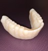Figure 15: Dentca’s 3D printed try-in.