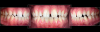 Fig 11. Esthetic treatment planning for a patient presenting for veneers is aided by the use of the SDL for photos taken by a dental assistant.