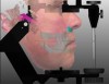 Fig 6. This digitized photorealistic 3D image is used for face-in planning of posterior edentulous areas with virtual articulation.