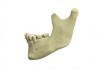 Fig 7. The schematic illustration describes d as a fraction of the distance from the incisal point to the cusp in question.