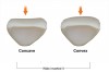 Fig 5. From an incisal perspective, a concave
facial contour causes the tooth to appear
thinner, while a convex facial contour causes
the tooth to appear wider.