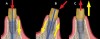 Fig 1. Comparison of compressive (A), shear (B), and tensile (C) loading on implants. (Red arrow is direction of load placed on the implant, and yellow arrow is direction of the resulting loading force.)