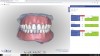 Figure 16: The digital denture design software displays the frontal view.