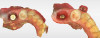 Fig 17. Intraoral scan of a scan body on the implant (left) and after clean-up of the soft tissue in the software (right) demonstrating the emergence profile of a mandibular first molar.