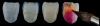 Fig 8. Fabrication of a monolithic 3Y zirconia crown. Left to right: pre-sintered framework received from mill with slight hand-carved texturing, pre-sintered framework with painted dip stains, sintered framework, application of veneering porcelain to obtain 3-dimensional color and translucency characterization.