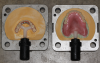 Fig 3. Laboratory processing of prosthesis involves incorporating teeth and wax prosthesis into stone molds, also known as flasking.