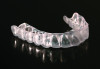 Fig 2. Clear orthodontic aligners manufactured in dental laboratories (images courtesy of Orthodent Laboratory).
