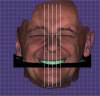 Fig 12. Accurately placing the incisal edge positions of the maxillary and mandibular arches and visualizing the occlusal plane of the posterior teeth.