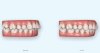 Fig 6. An example of a clear aligner outcome simulation.