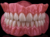 Fig 2. Flexcera Smile from Desktop Health.