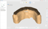 Fig 8. Digital acquisition of a precise measurement of the surface area of the primary bar.