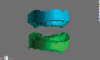 Fig 5. Edentulous ridges captured in 3D space in the correct relationship based on the position of the existing prothesis (as shown in Fig 4); the landing area notches are used for file stitching.