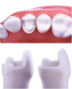 (4.) Examples of different preparation designs for partial-coverage restorations.(3. AND 4.) Examples of different preparation designs for partial-coverage restorations.