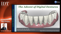 The Advent of Digital Dentures Webinar Thumbnail