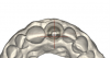 (33.) Single anterior custom abutment workflow.