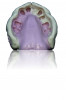 Figure 2: Image of a custom tray impression