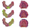 Figure 3: Images of template for successful scanning; images obtained from AlignTech.