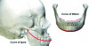 Figure 6: The Curve of Spee and the Curve of Wilson.