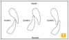 Figure 7: Angle’s Classifications for Occlusion.