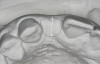 Figure 8 These images summarize the various dimensional assessments that underscore the Rules of Six guidelines, which enable simple planning for uncomplicated single-tooth dental implant therapy: Finding mesiodistal or inter-radicular (Fig 7), buccolingu