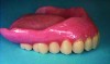 Fig 4. Completed denture.