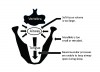 Fig 1. Factors contributing to obstructive sleep apnea (OSA).