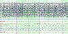 Fig 2. Sample of PSG recording during normal adult sleep. Each epoch represents 30 seconds of time. See text for description of channels.