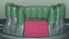 Fig 5. Virtual design of maxillary (Fig 4) and mandibular (Fig 5) provisional restorations, transparent view.