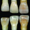 Fig 1. Standard deviation, central incisors.