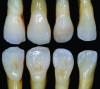 Fig 16. Lateral incisors: facial and lingual views.