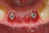 Figure 10  Clinical healing completed.